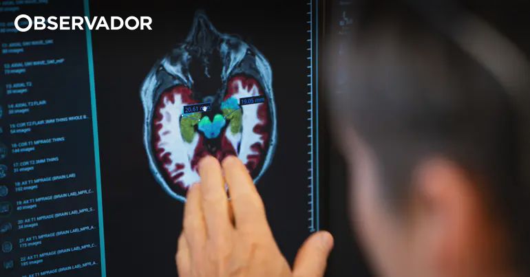 Estudo mostra possível tratamento para síndrome de Dravet – Observador Estudo mostra possível tratamento para síndrome de Dravet – Observador